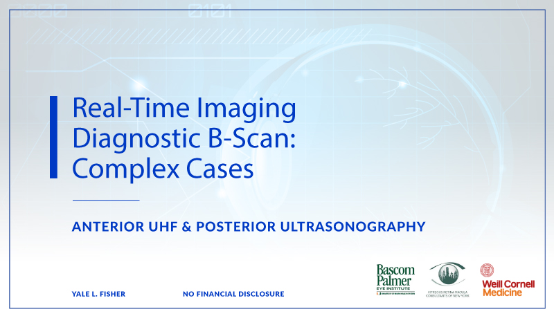 Real-Time Imaging Diagnostic B-Scan Is Critical For Complex Cases